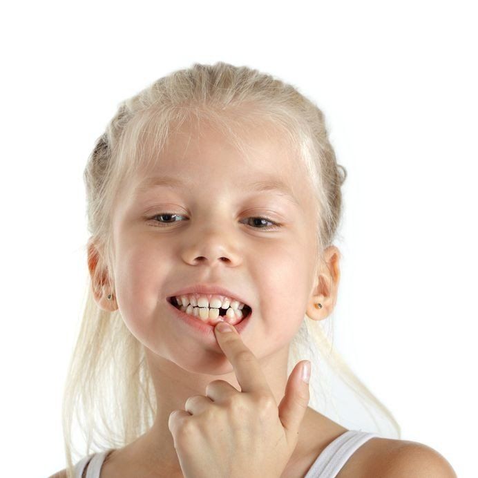 replace missing tooth 